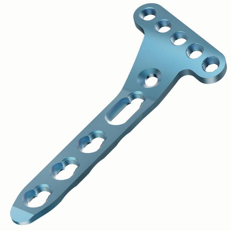 Auxein - 2.4мм Блокуючий дистальний долонний промінь пластина, (5 головних отв.)